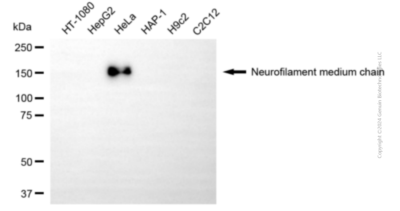 KD-Validated Anti-NEFM Mouse Monoclonal Antibody ABG1923