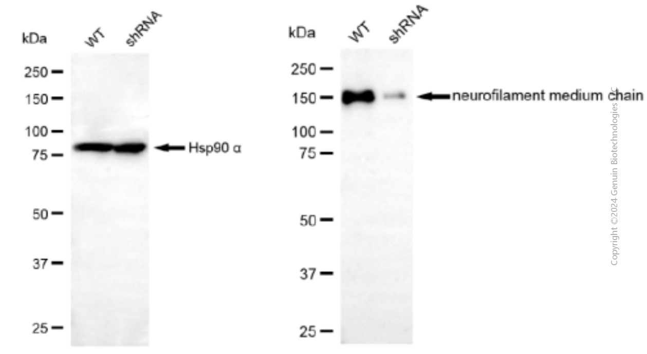 KD-Validated Anti-NEFM Mouse Monoclonal Antibody ABG1923