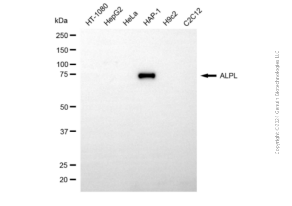 KD-Validated Anti-ALPL Mouse Monoclonal Antibody ABG1924
