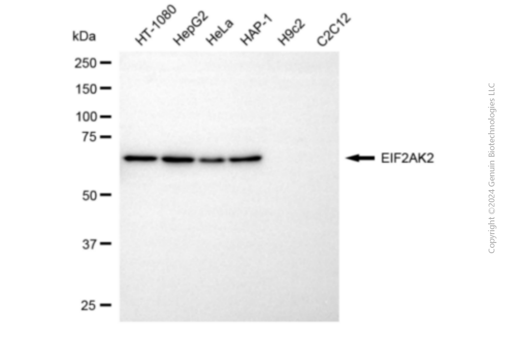 KD-Validated Anti-eIF-2A protein kinase 2 Mouse Monoclonal Antibody ABG1925