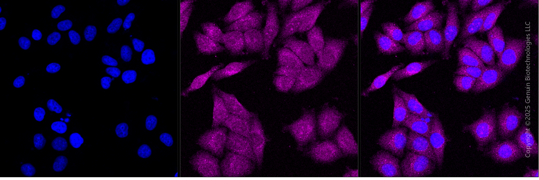 KD-Validated Anti-AKR1A1 Mouse Monoclonal Antibody ABG1927