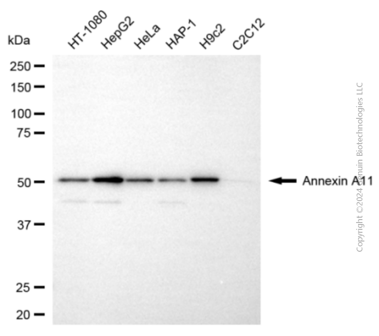 KD-Validated Anti-Annexin A11 Mouse Monoclonal Antibody ABG1928