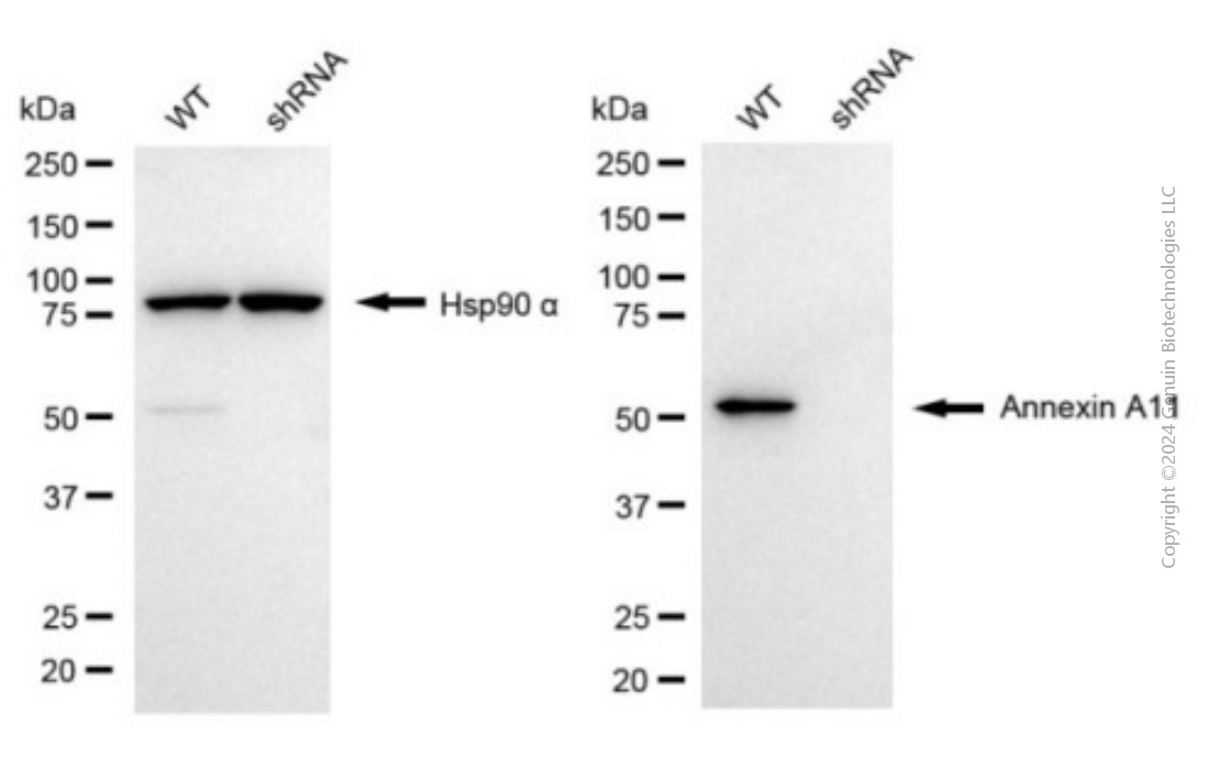 KD-Validated Anti-Annexin A11 Mouse Monoclonal Antibody ABG1928