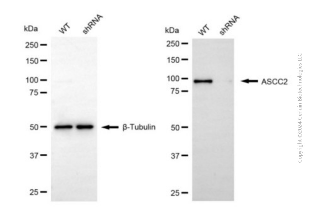 KD-Validated Anti-ASCC2 Mouse Monoclonal Antibody ABG1933
