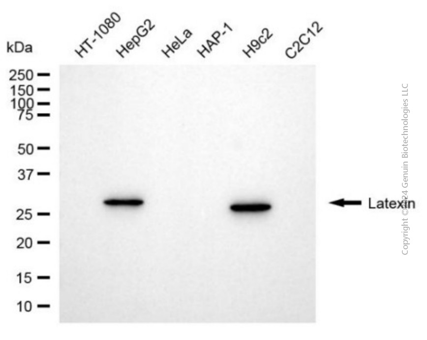 KD-Validated Anti-Latexin Mouse Monoclonal Antibody ABG1935