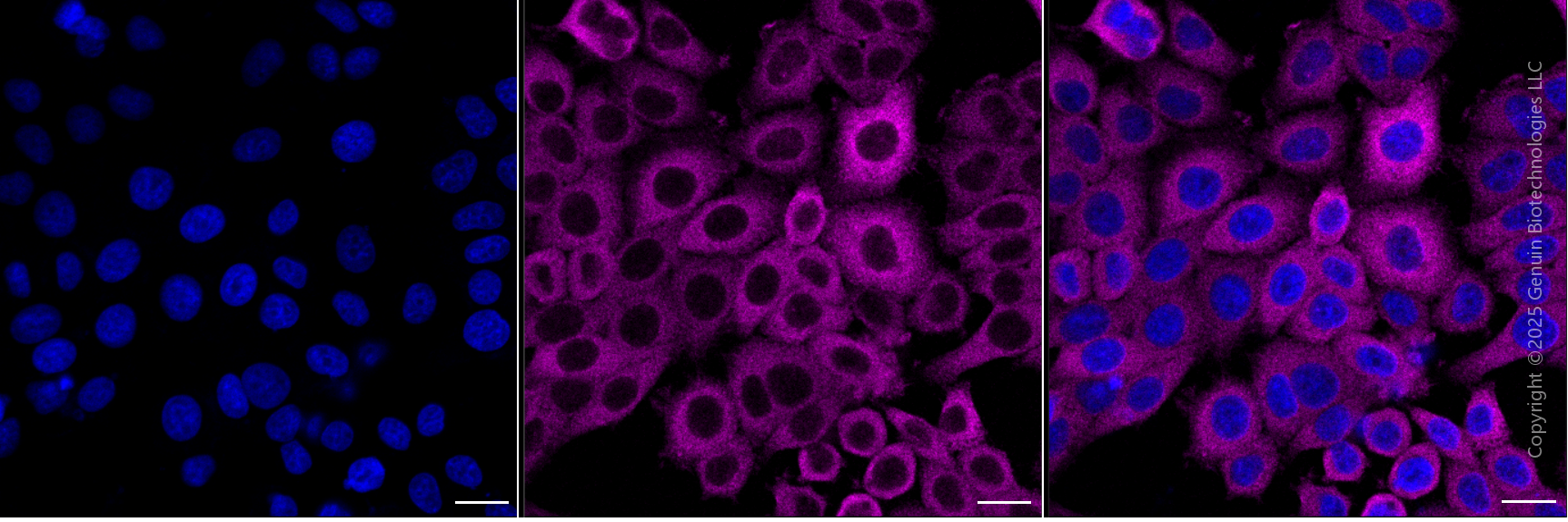 KD-Validated Anti-PFKP Mouse Monoclonal Antibody ABG1936