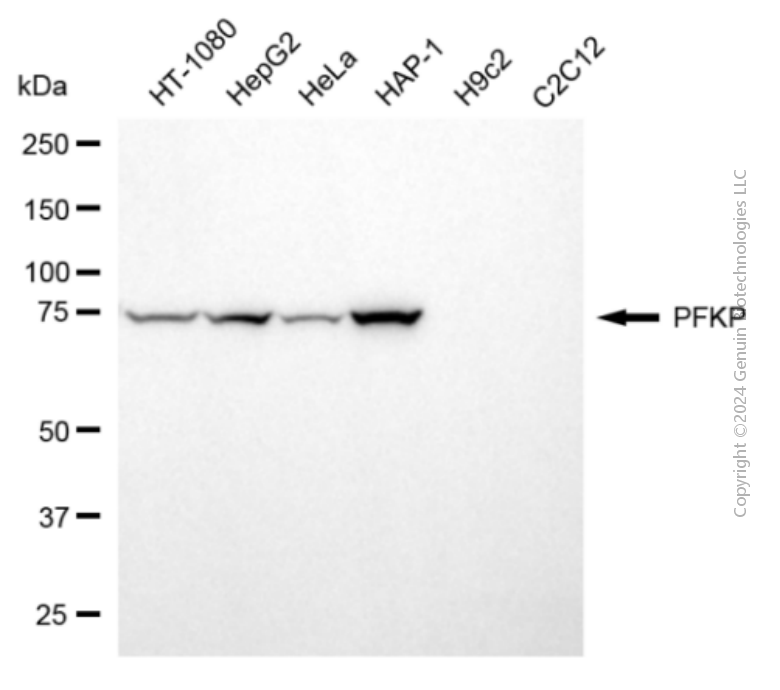 KD-Validated Anti-PFKP Mouse Monoclonal Antibody ABG1936