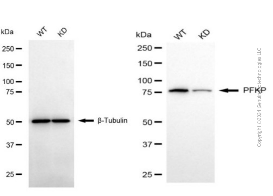 KD-Validated Anti-PFKP Mouse Monoclonal Antibody ABG1936