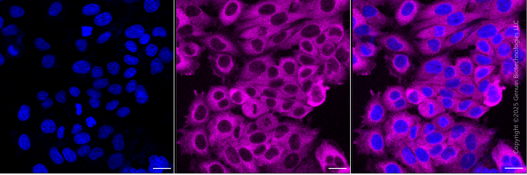 KD-Validated Anti-PFKP Mouse Monoclonal Antibody ABG1937