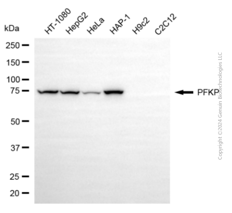 KD-Validated Anti-PFKP Mouse Monoclonal Antibody ABG1937