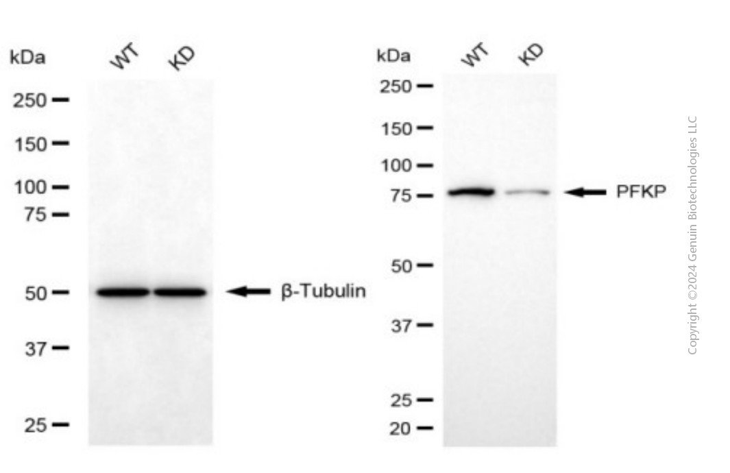 KD-Validated Anti-PFKP Mouse Monoclonal Antibody ABG1937