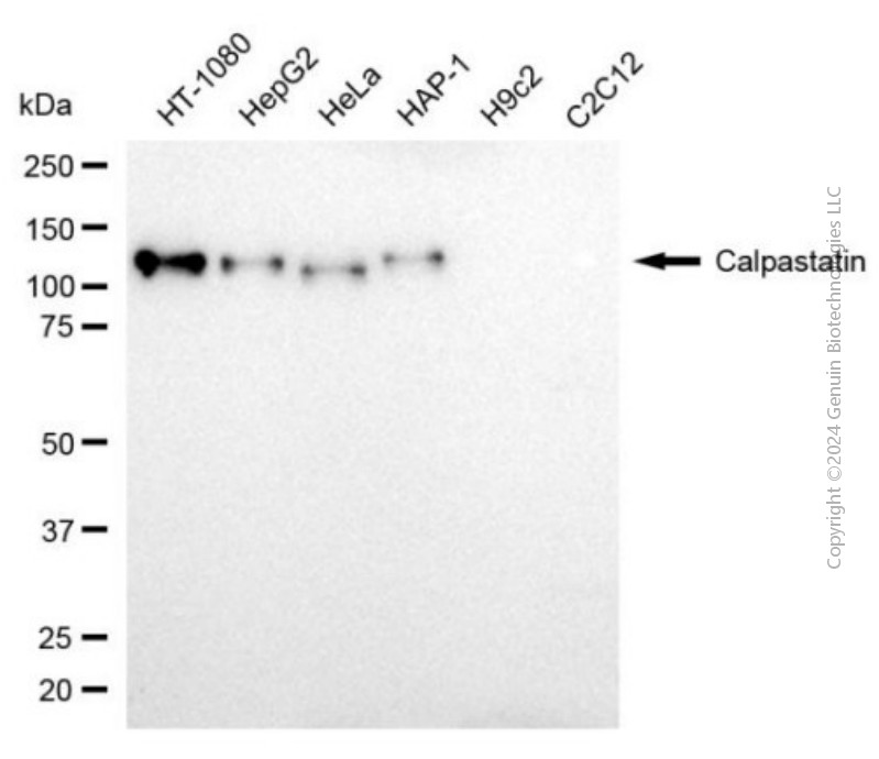 KD-Validated Anti-Calpastatin Mouse Monoclonal Antibody ABG1940