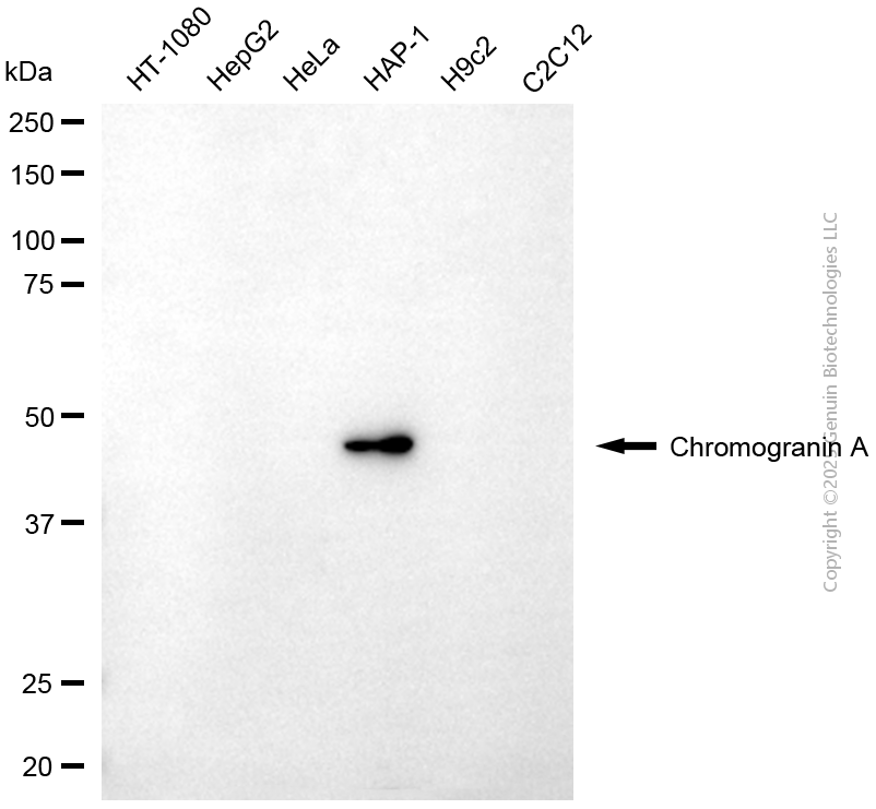 KD-Validated Anti-Chromogranin A Mouse Monoclonal Antibody ABG1943