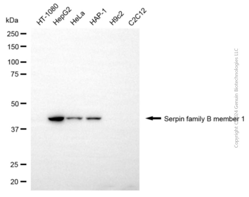 KD-Validated Anti-SERPINB1 Mouse Monoclonal Antibody ABG1944
