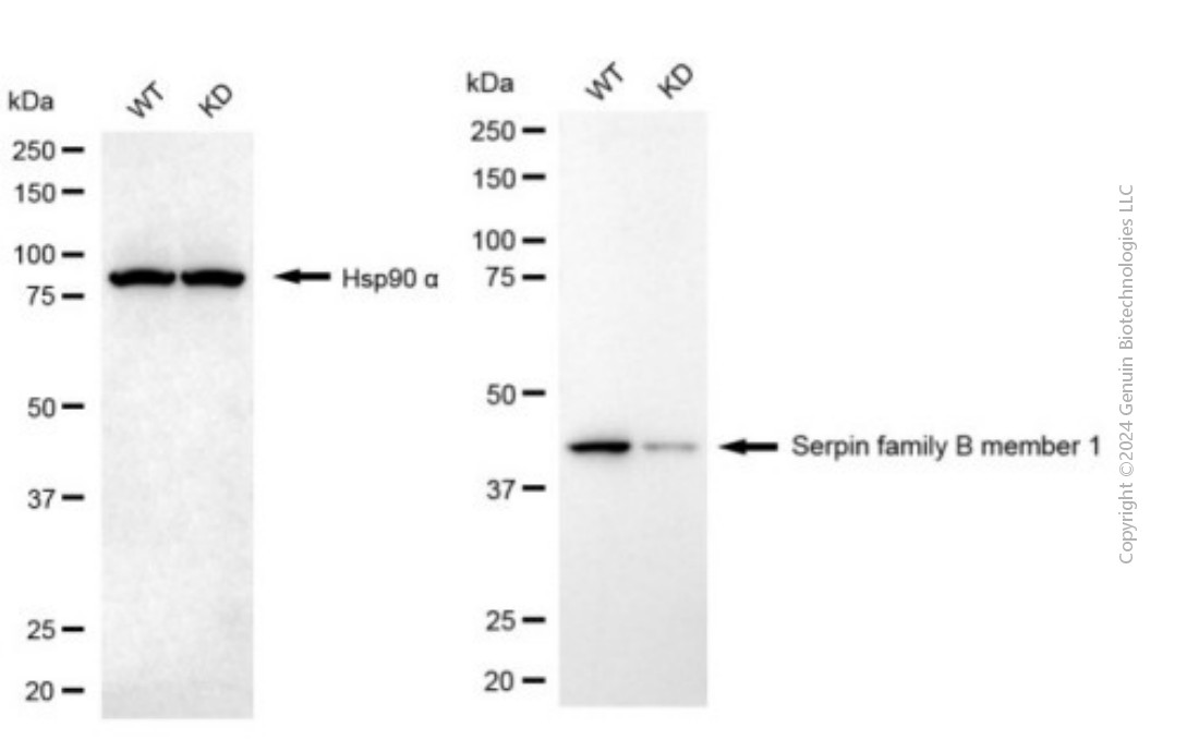 KD-Validated Anti-SERPINB1 Mouse Monoclonal Antibody ABG1944