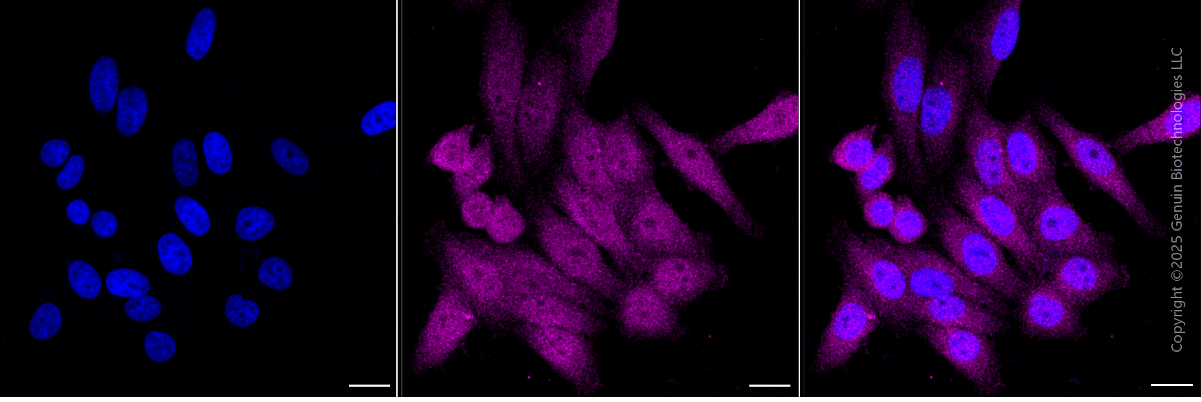 KD-Validated Anti-SERPINB1 Mouse Monoclonal Antibody ABG1945
