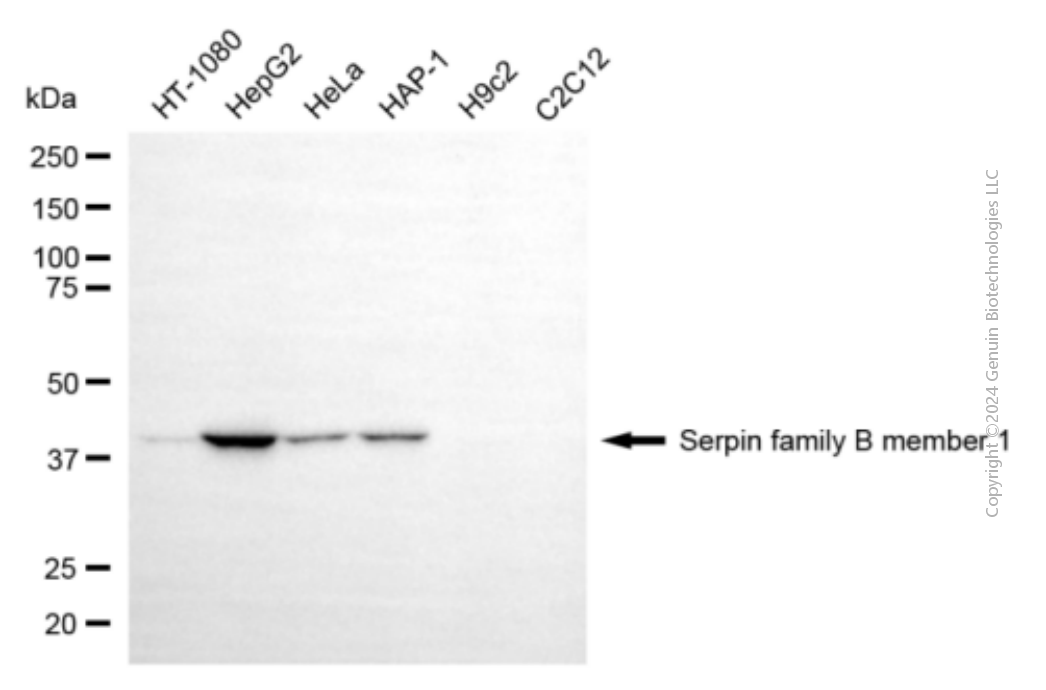 KD-Validated Anti-SERPINB1 Mouse Monoclonal Antibody ABG1945