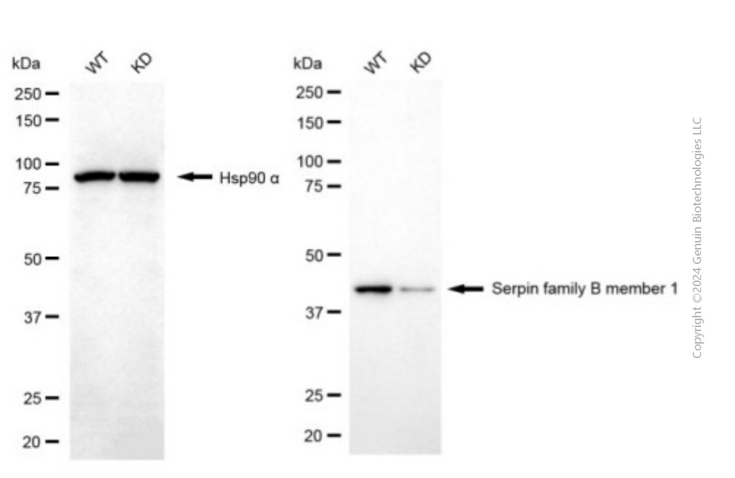 KD-Validated Anti-SERPINB1 Mouse Monoclonal Antibody ABG1945