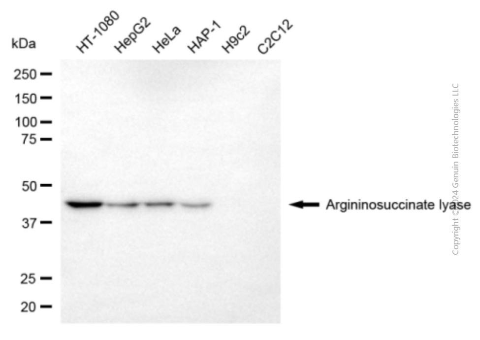 KD-Validated Anti-Argininosuccinate Lyase Mouse Monoclonal Antibody ABG1949