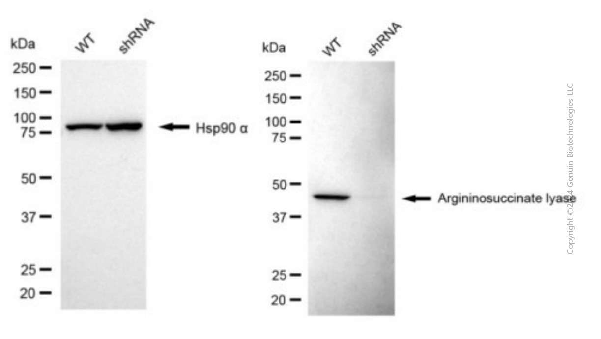 KD-Validated Anti-Argininosuccinate Lyase Mouse Monoclonal Antibody ABG1949