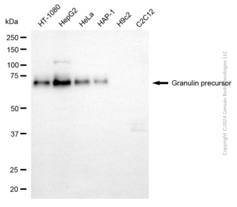 KD-Validated Anti-Granulin Precursor Mouse Monoclonal Antibody ABG1950