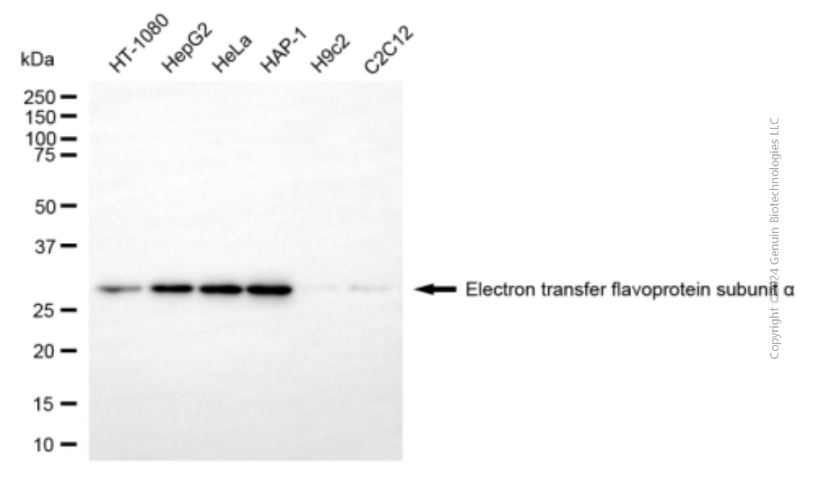 KD-Validated Anti-ETFA Mouse Monoclonal Antibody ABG1952