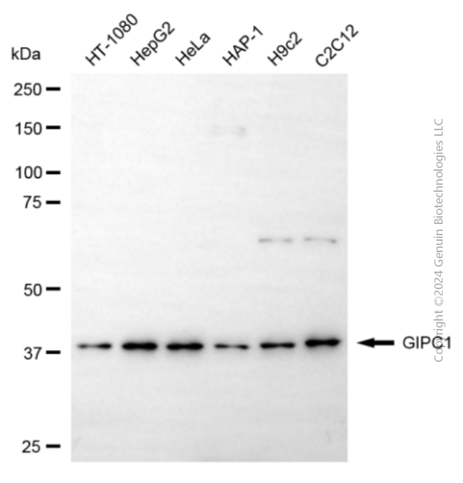 KD-Validated Anti-GIPC1 Mouse Monoclonal Antibody ABG1956