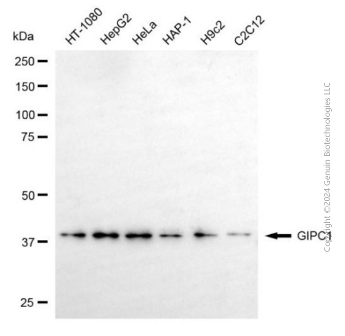 KD-Validated Anti-GIPC1 Mouse Monoclonal Antibody ABG1957