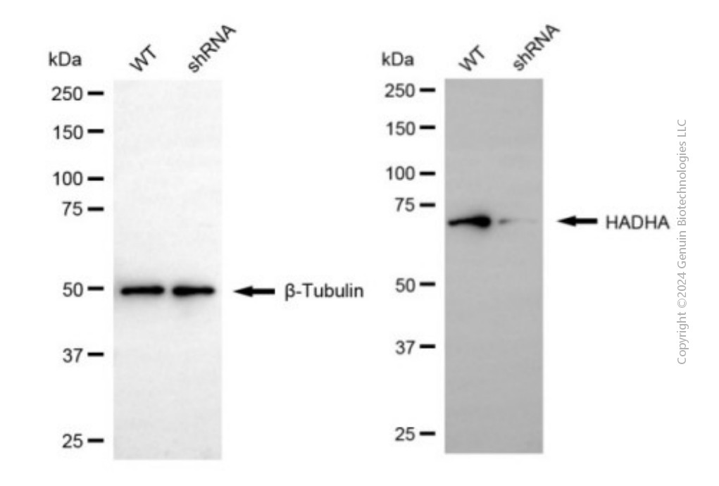 KD-Validated Anti-HADHA Mouse Monoclonal Antibody ABG1958