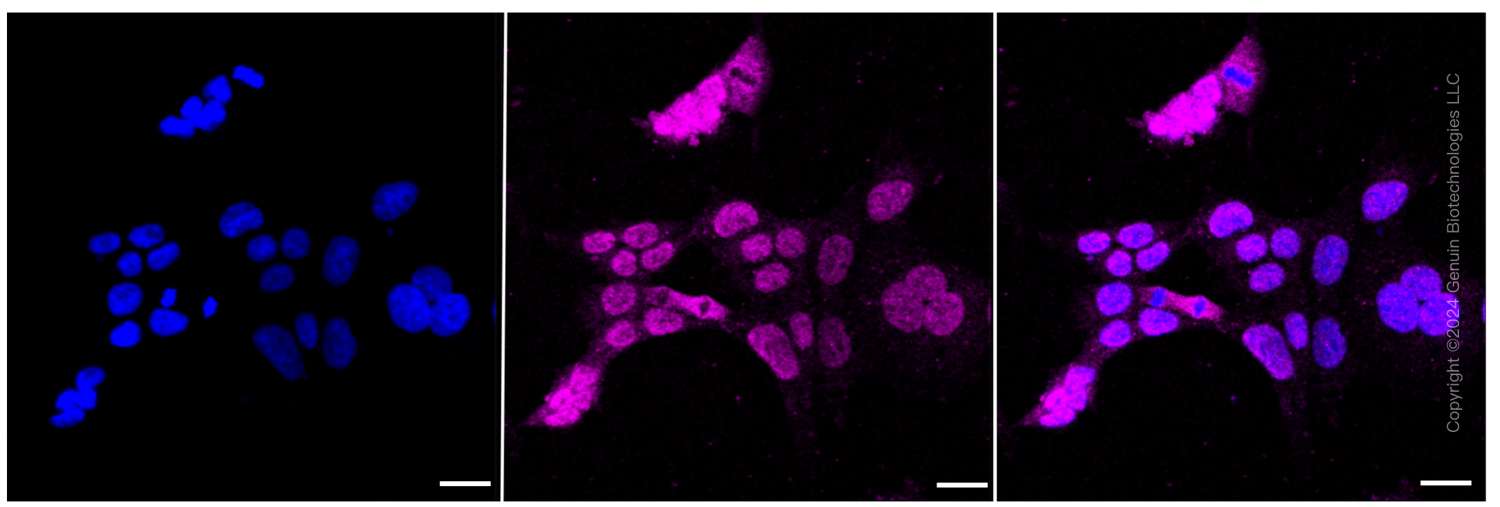 KD-Validated Anti-IRAK3 Rabbit Monoclonal Antibody ABG1959