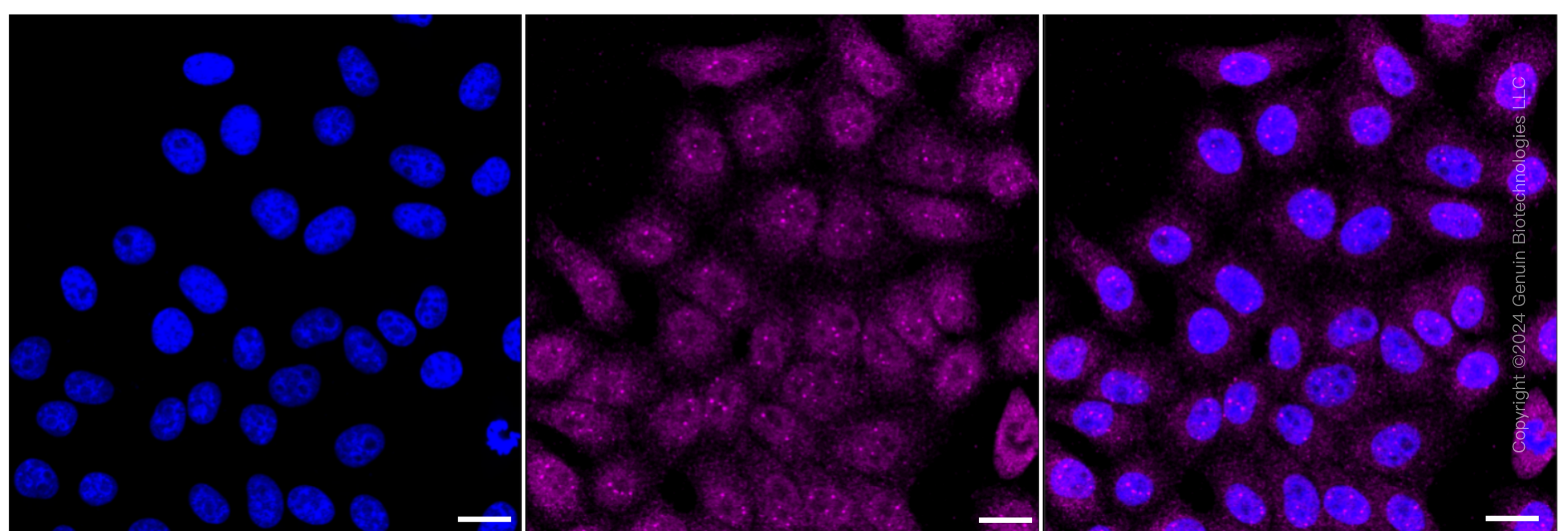KD-Validated Anti-GRK2 Rabbit Monoclonal Antibody ABG1966