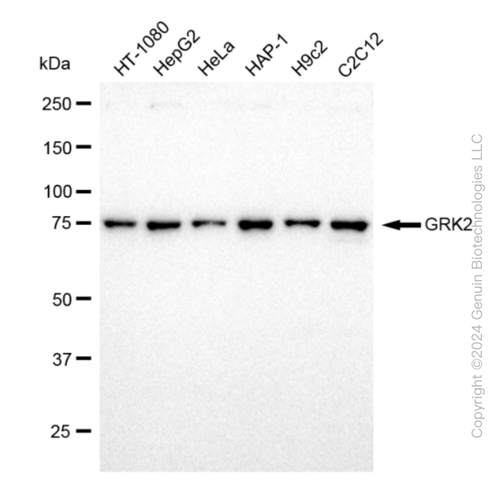 KD-Validated Anti-GRK2 Rabbit Monoclonal Antibody ABG1966