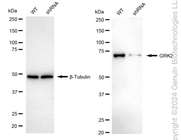 KD-Validated Anti-GRK2 Rabbit Monoclonal Antibody ABG1966