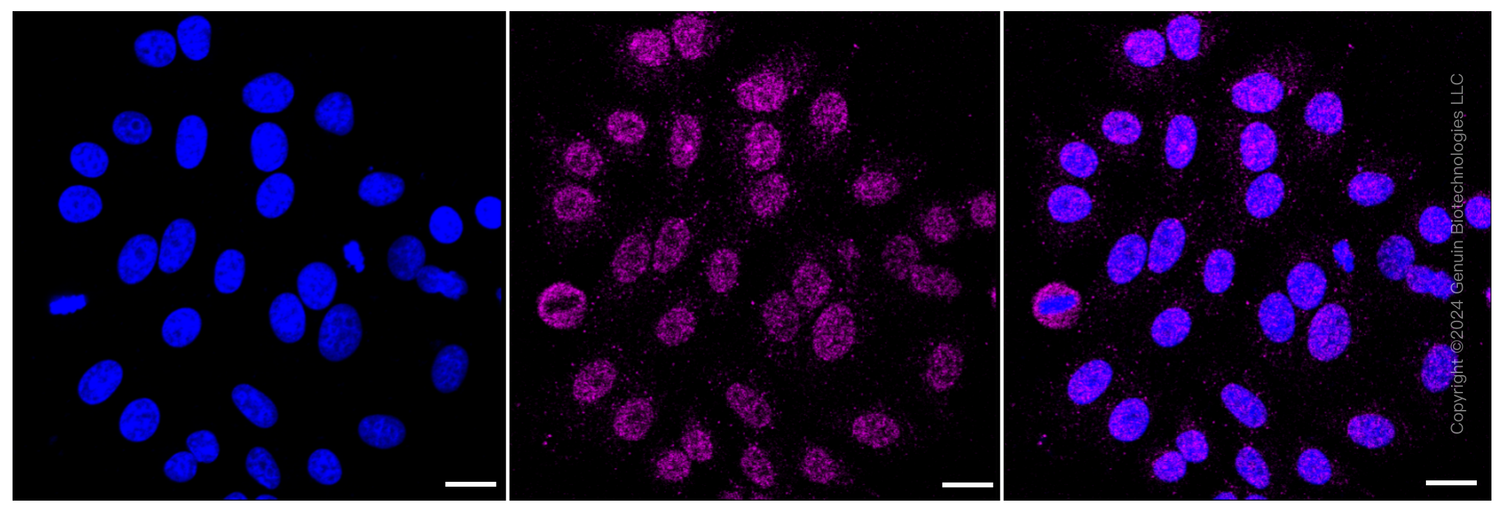KD-Validated Anti-Glucose-6-phosphate dehydrogenase Rabbit Monoclonal Antibody ABG1968