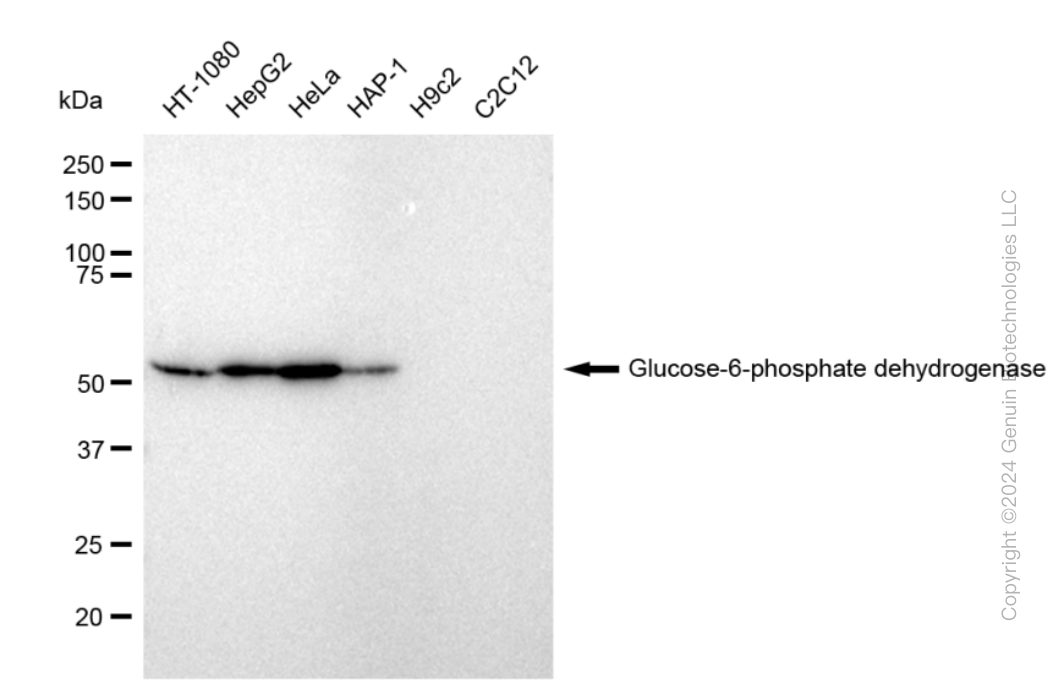 KD-Validated Anti-Glucose-6-phosphate dehydrogenase Rabbit Monoclonal Antibody ABG1968