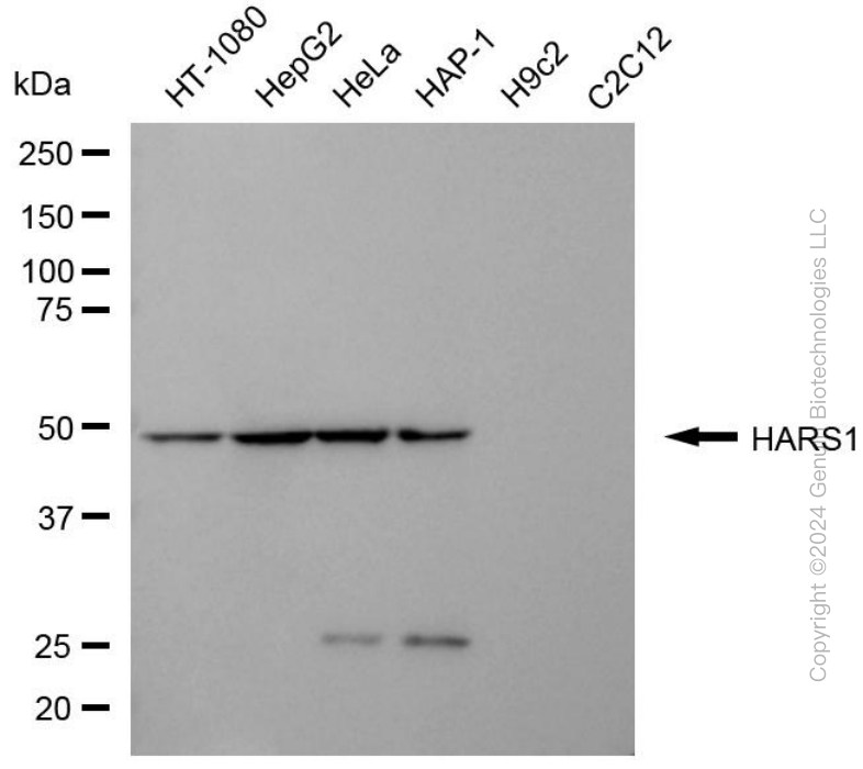 KD-Validated Anti-HARS1 Mouse Monoclonal Antibody ABG1970