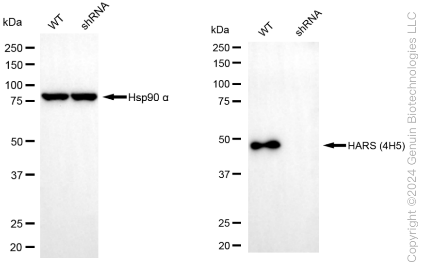 KD-Validated Anti-HARS1 Mouse Monoclonal Antibody ABG1970