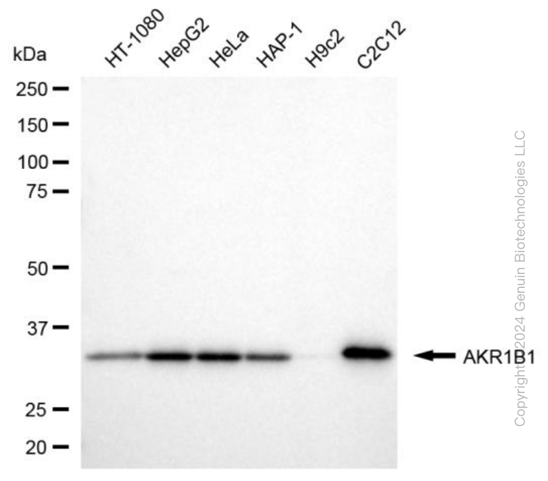 KD-Validated Anti-AKR1B1 Mouse Monoclonal Antibody ABG1973