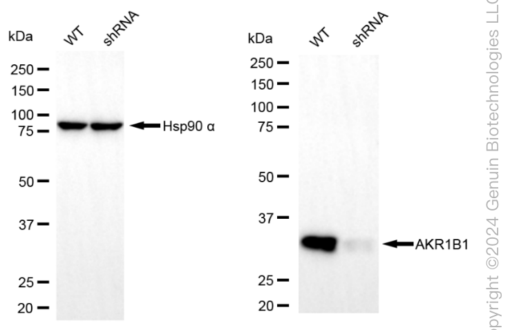 KD-Validated Anti-AKR1B1 Mouse Monoclonal Antibody ABG1973