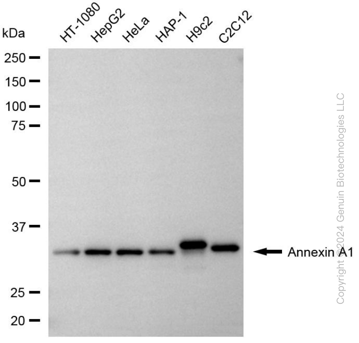 KD-Validated Anti-Annexin A1 Rabbit Monoclonal Antibody ABG1975