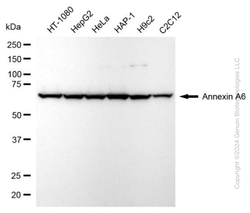 KD-Validated Anti-Annexin A6 Rabbit Monoclonal Antibody ABG1976