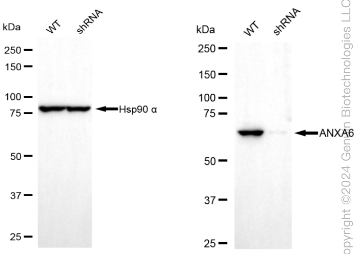 KD-Validated Anti-Annexin A6 Rabbit Monoclonal Antibody ABG1976