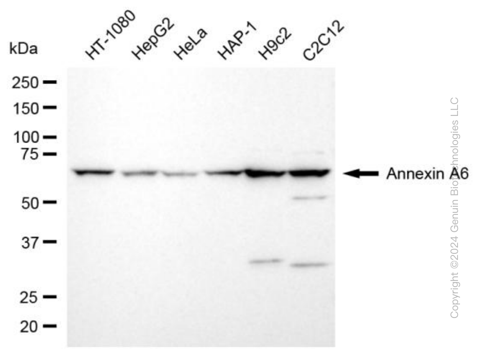 KD-Validated Anti-Annexin A6 Rabbit Monoclonal Antibody ABG1977