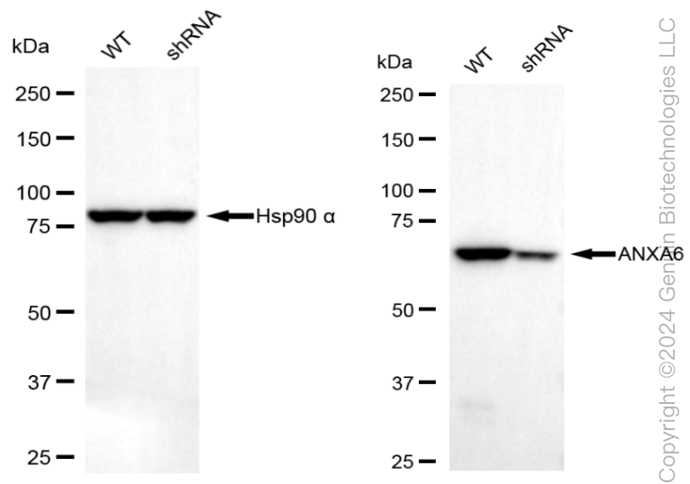 KD-Validated Anti-Annexin A6 Rabbit Monoclonal Antibody ABG1977