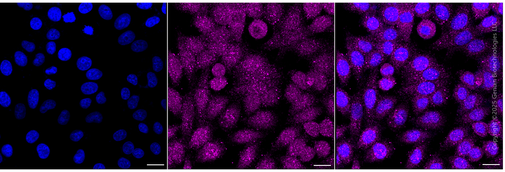 KD-Validated Anti-AXL Rabbit Monoclonal Antibody ABG1979