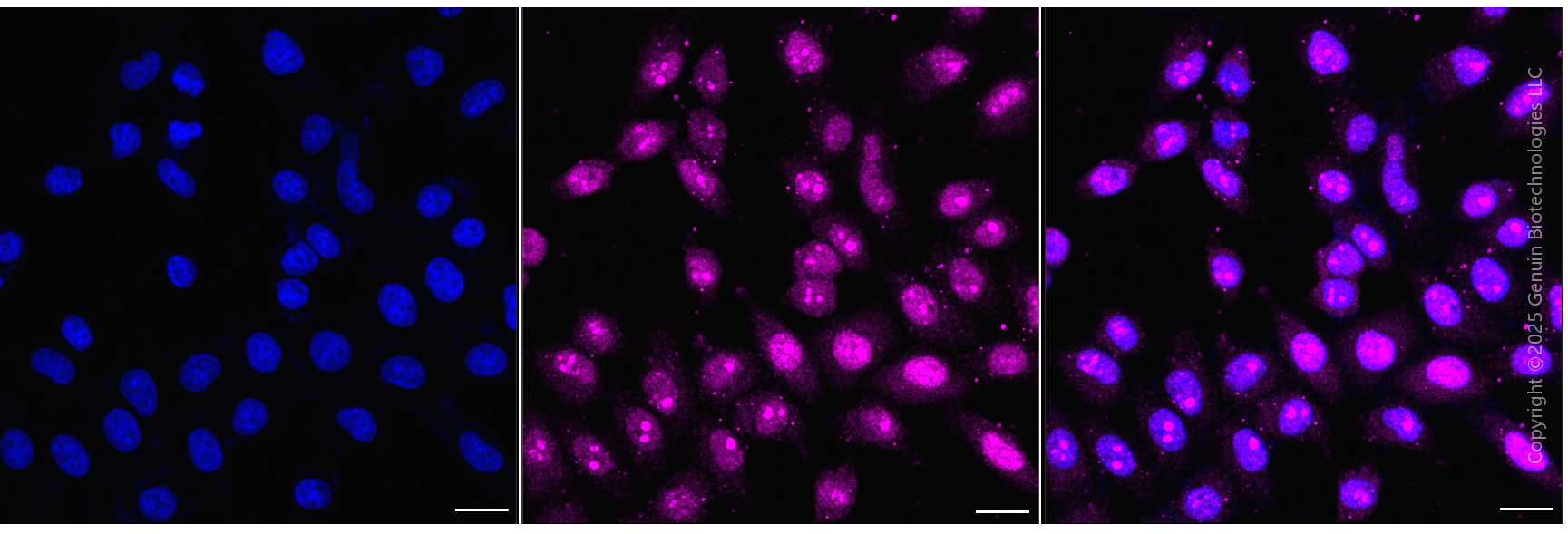 KD-Validated Anti-ATP6V1A Rabbit Monoclonal Antibody ABG1982