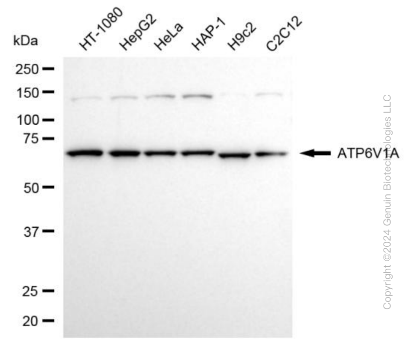 KD-Validated Anti-ATP6V1A Rabbit Monoclonal Antibody ABG1982