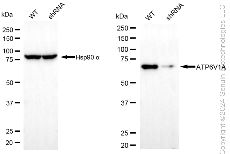 KD-Validated Anti-ATP6V1A Rabbit Monoclonal Antibody ABG1982