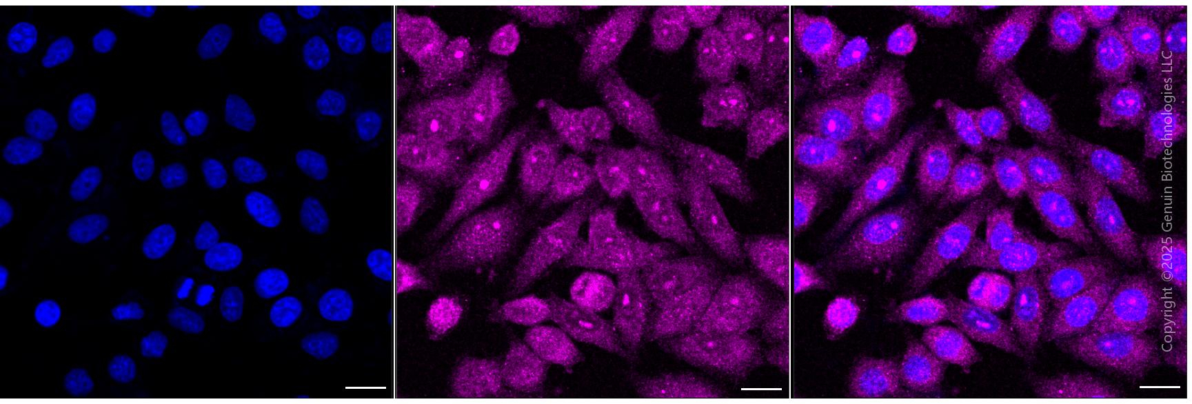 KD-Validated Anti-BCR Rabbit Monoclonal Antibody ABG1983