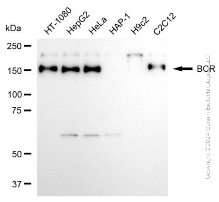 KD-Validated Anti-BCR Rabbit Monoclonal Antibody ABG1983